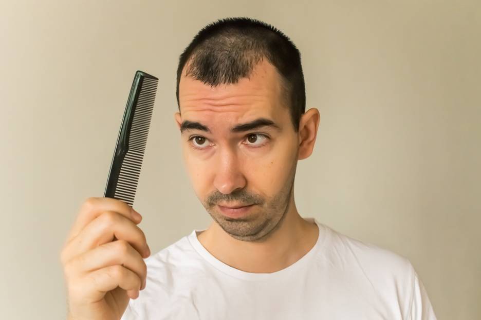Natural Solutions for Thinning Hair